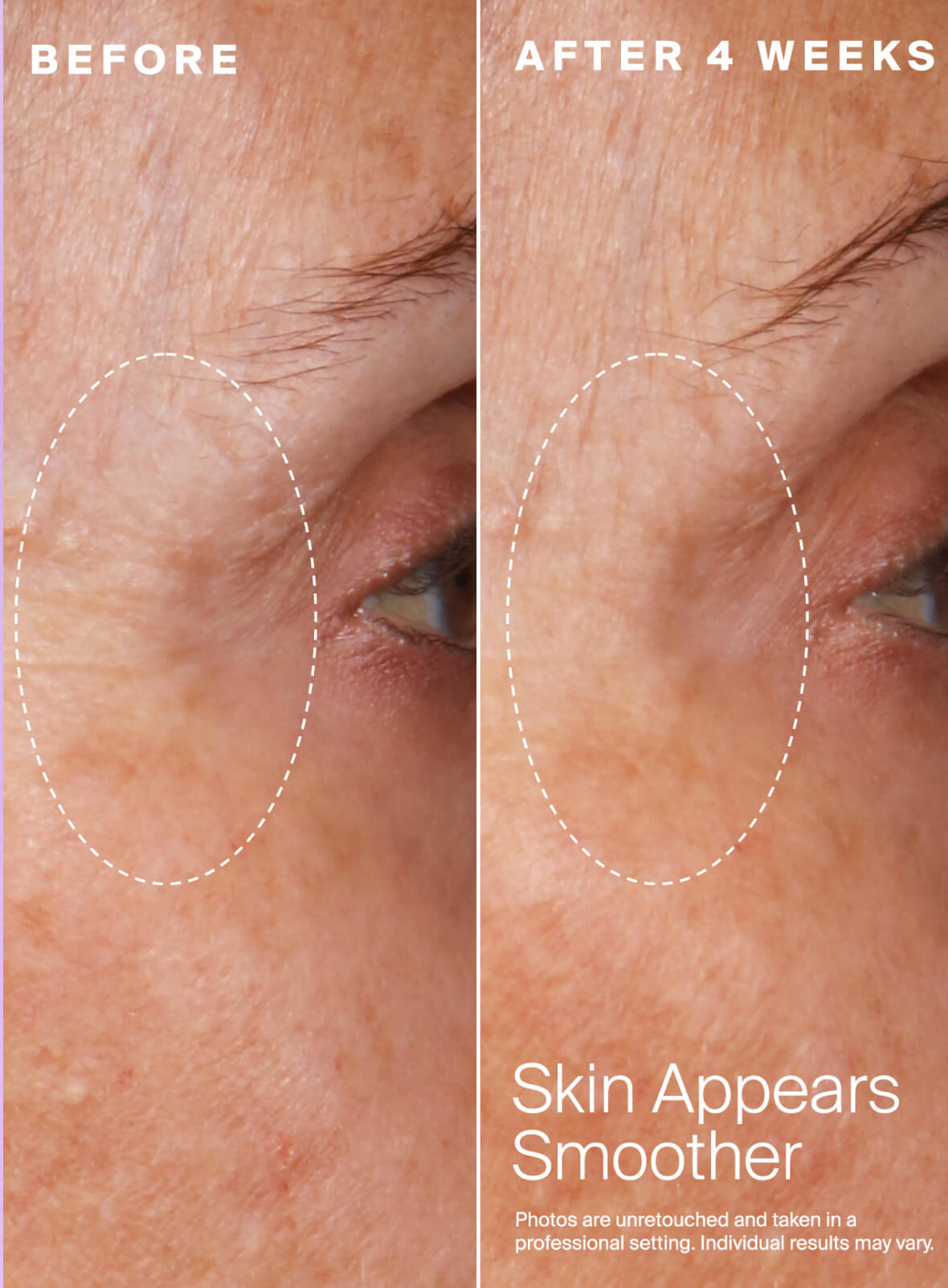 Daily Dose Bioretinol + Mineral SPF 40 Fluid Before & After imagery. Before image shown on left, After image shown on right. Copy callout "Skin Appears Smoother. Photos are unretouched and taken in a professional setting. Individual results may vary.